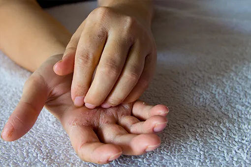 HUMITOPIC kosmetyki do skóry atopowej