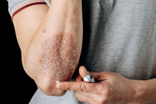 HUMITOPIC kosmetyki do skóry atopowej