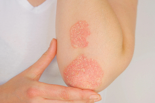 HUMITOPIC kosmetyki do skóry atopowej